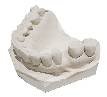 kit-denture